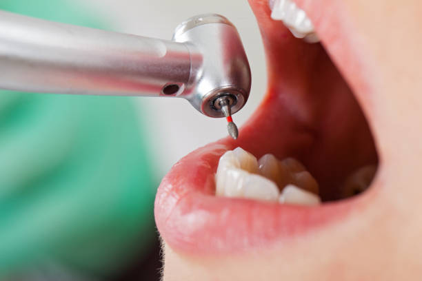 Best Emergency Root Canal Treatment in Garden City, KS